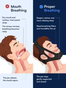 Sleeping Jaw Cover (Anti-Snoring)